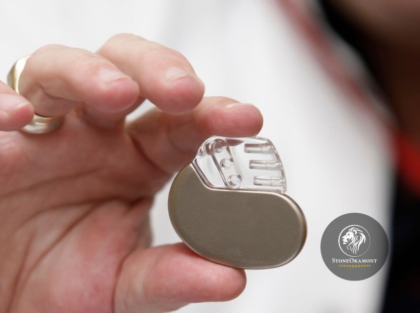 Como registrar marcapasso na ANVISA?