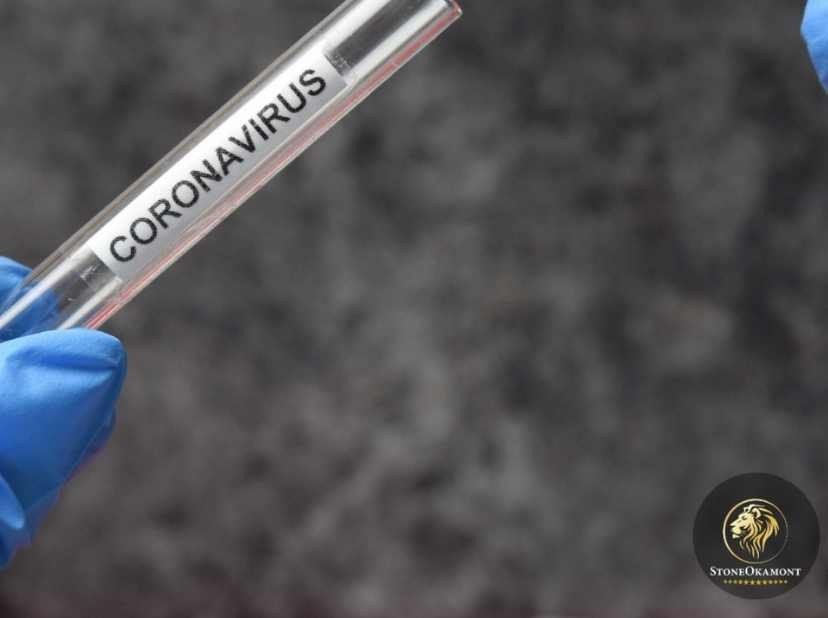 Como registrar testes para COVID-19 na Anvisa