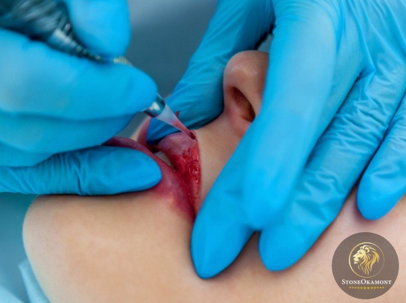 Como registrar produtos para micropigmentação? 