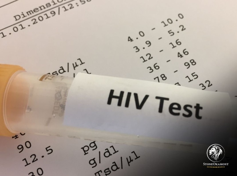 Como regularizar autoteste para HIV junto à ANVISA?